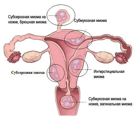 Выкройки блузок с рукавами фонариками Выкройки блузок с рукавами фонариками